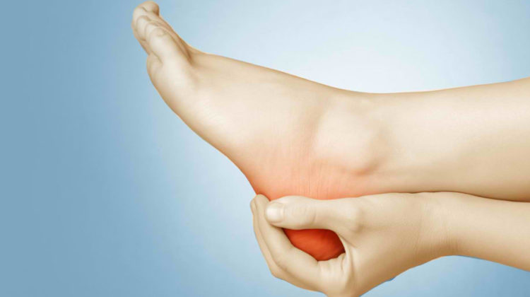 Heel Pain Caused by Plantar Fasciitis