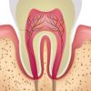 <?php echo Why our teeth get sensitive to heat and cold; ?>